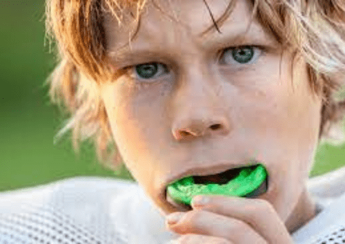 mouthguard