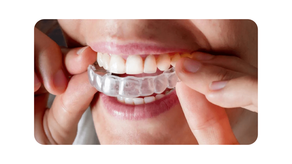 invisalign