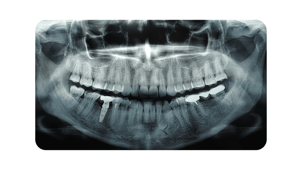 radiographs