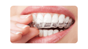 invisalign