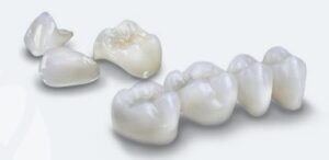 TYPES-OF-CROWNS-300x146
