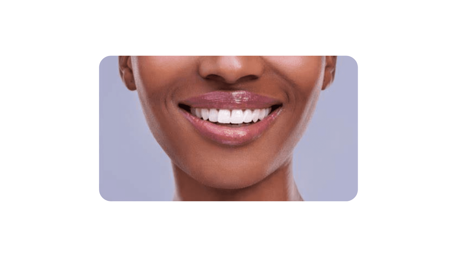 Million Dollar Smile Summerlin - Summerlin Dental Solutions