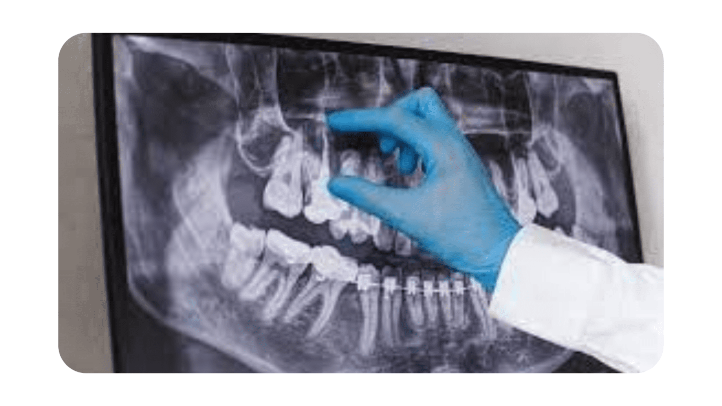 Dental XRays While Pregnant Summerlin Dental Solutions