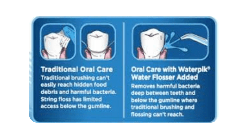 Waterpik vs. Flossing: The Great Comparison 3