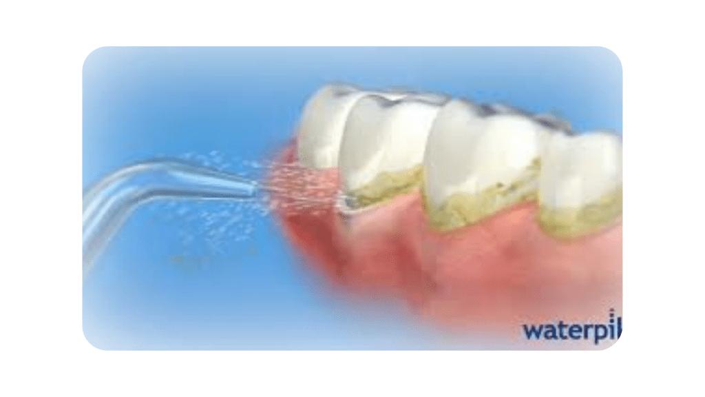 Waterpik vs. Flossing: The Great Comparison 2