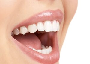 IS HYDROGEN PEROXIDE BOTH SAFE AND EFFICIENT FOR TEETH WHITENING IN SUMMERLIN? 3