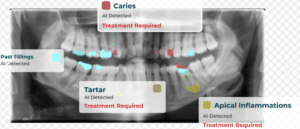 AI assisted comprehensive dental care. Multiple early issues