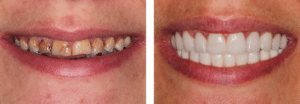 beautiful transformation