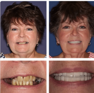 ‘Celebrity-caliber smile makeover results by Dr. Cohan at Summerlin Dental Solutions