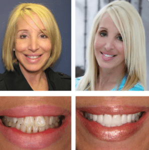 : 'Advanced computerized smile design technology used for veneer planning at Summerlin Dental Solutions