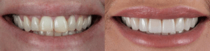 wedding Dreams at Summerlin Dental Solutions