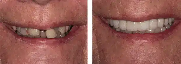 a before and after for this persons life change