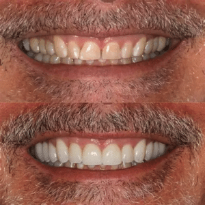 better smile at Summerlin Dental Solutions